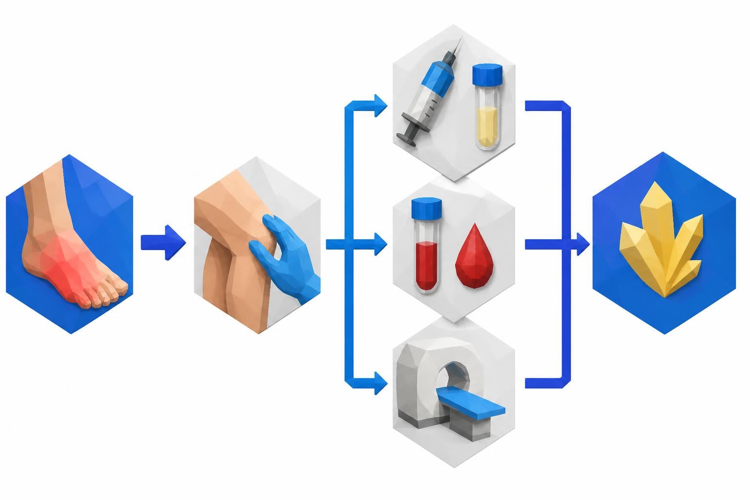 Gout Workup: The Tests Beyond Uric Acid