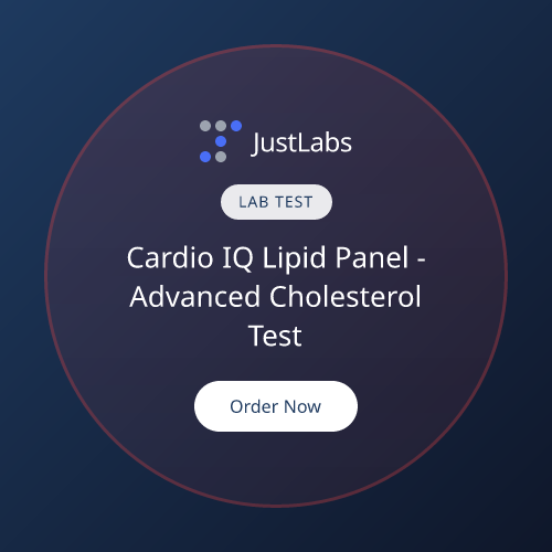 does u of c do advance lipid testing Lipid Panel, Cardio IQ - $8